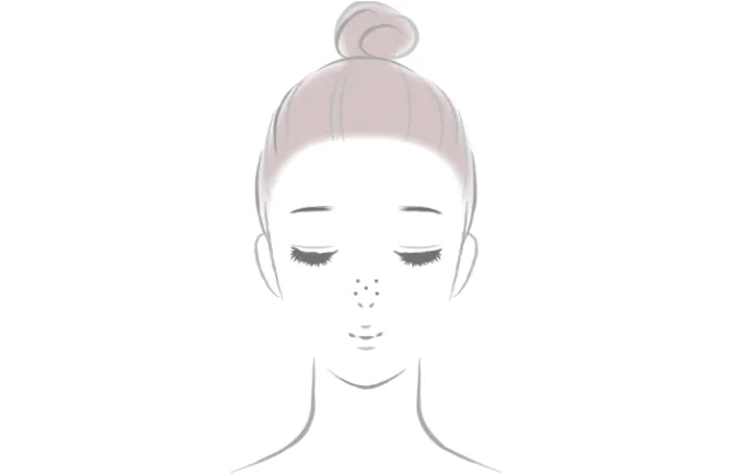 鼻、小鼻