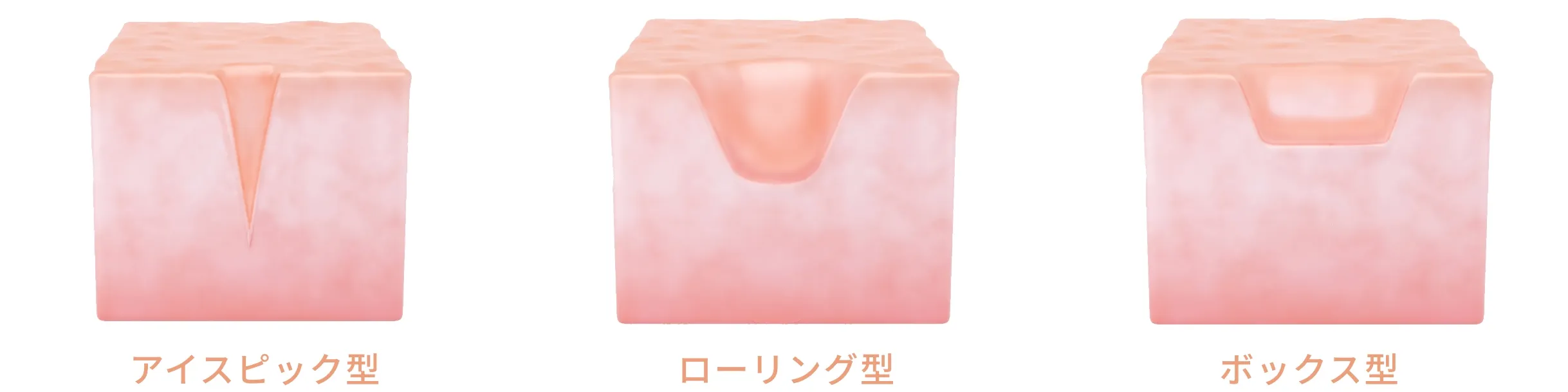 クレーターの種類