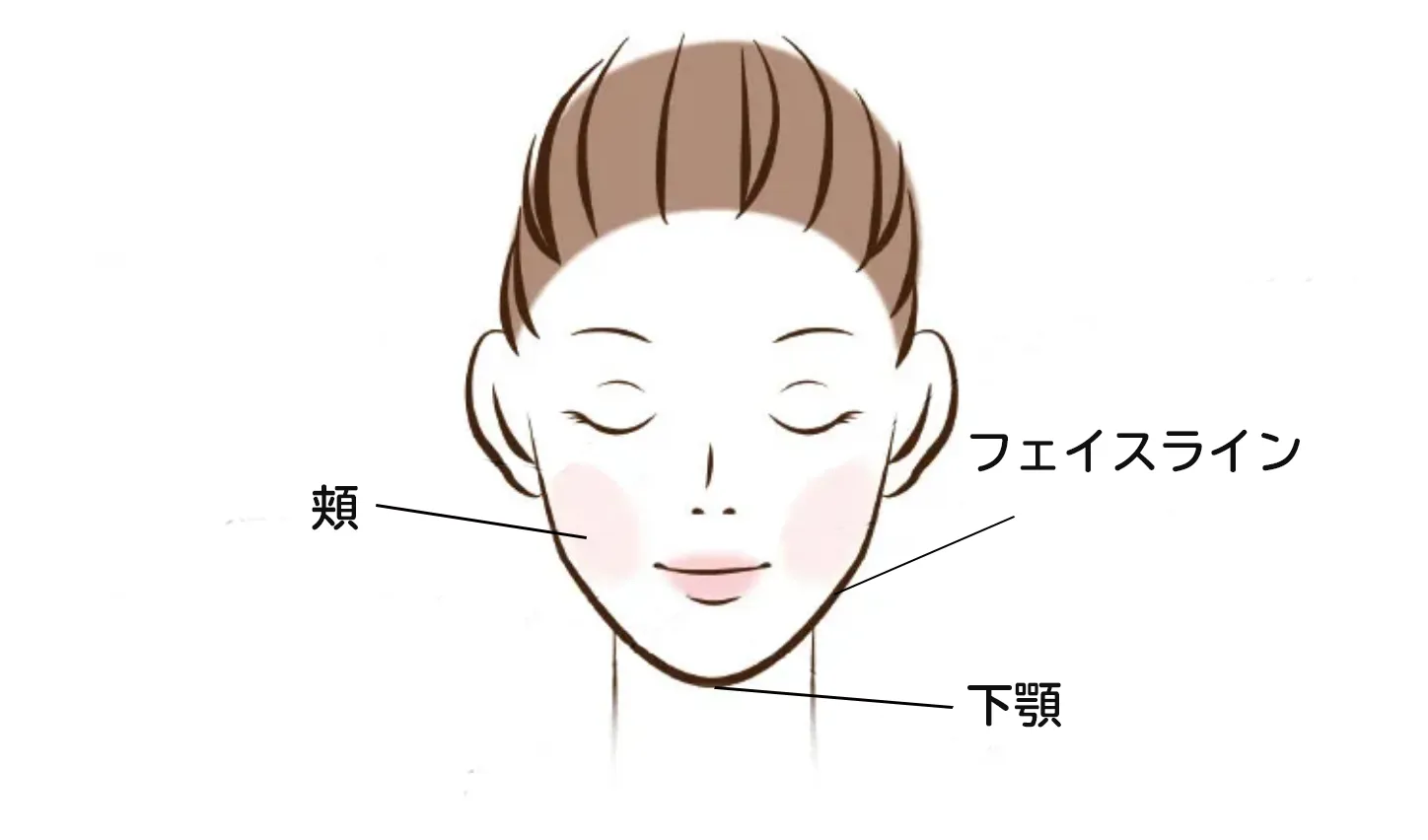 しこりニキビが発生しやすい場所