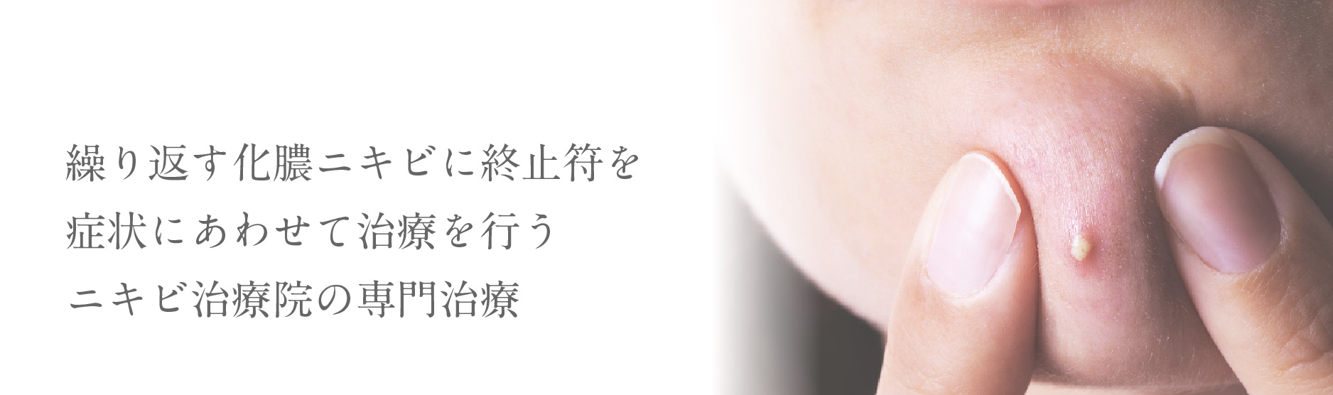 繰り返す化膿ニキビに終止符を症状にあわせて治療を行うニキビ治療院の専門治療