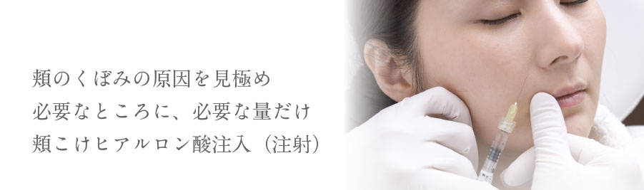 頬のくぼみの原因を見極め必要なところに、必要な量だけ頬こけヒアルロン酸注入（注射）