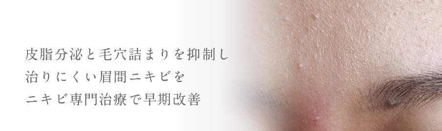 皮脂分泌と毛穴詰まりを抑制し治りにくい眉間ニキビをニキビ専門治療で早期改善