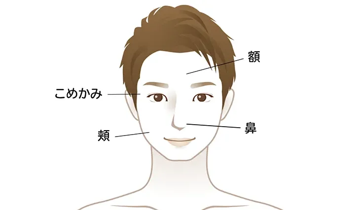 男性のシミが発生しやすい場所（顔）