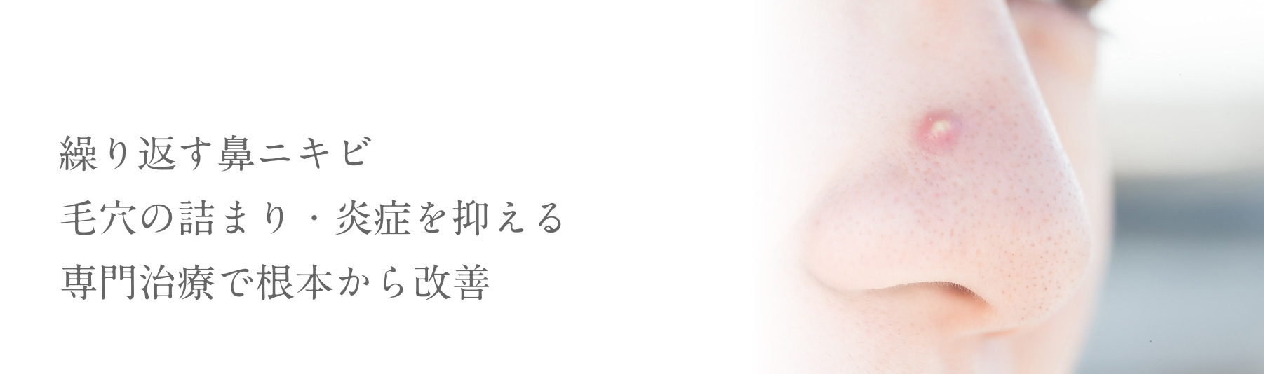 繰り返す鼻ニキビ毛穴の詰まり・炎症を抑える専門治療で根本から改善