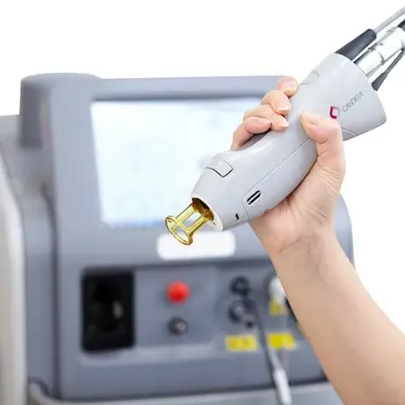 医療用レーザー脱毛