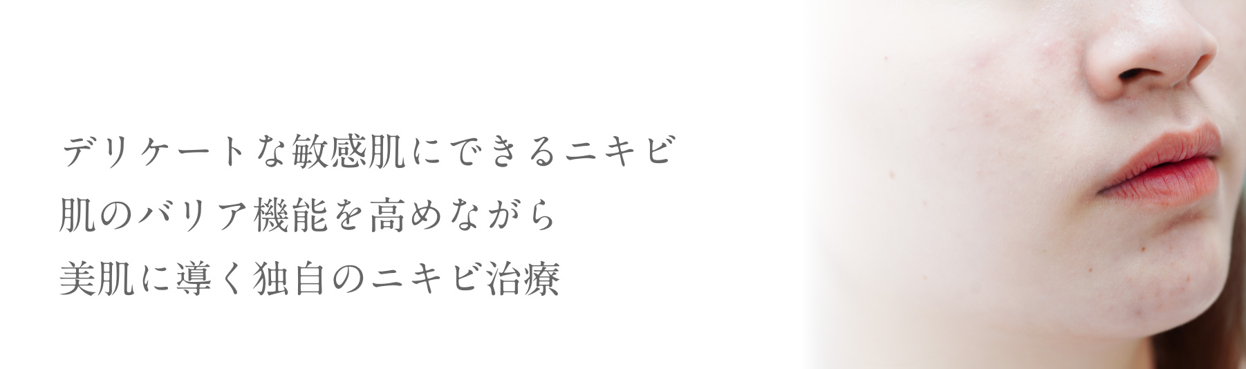 デリケートな敏感肌にできるニキビ肌のバリア機能を高めながら美肌に導く独自のニキビ治療