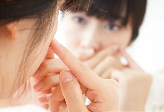 ニキビにやりがちなNGケア