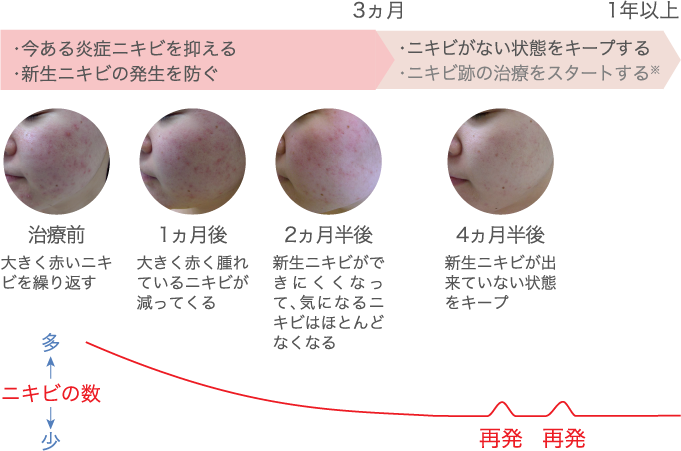 治療経過イメージ
