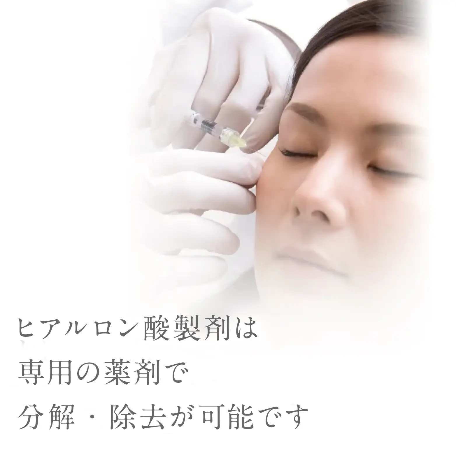 ヒアルロン酸製剤は専用の薬剤で分解・除去が可能です