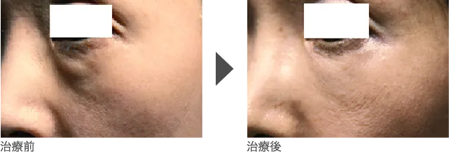 目周り 50代 女性