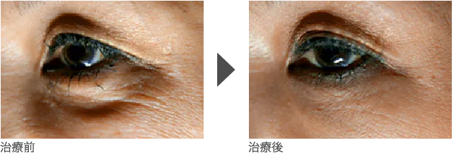 目周り 50代 女性