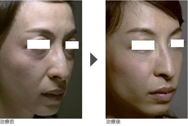 目周り 30代 女性