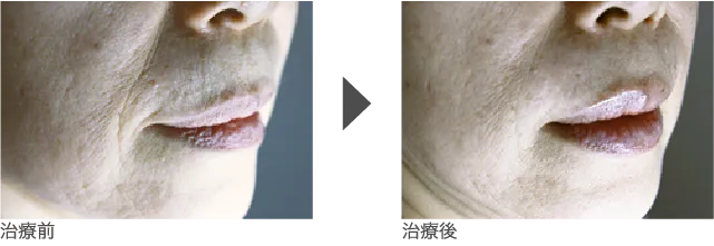口元 60代 女性