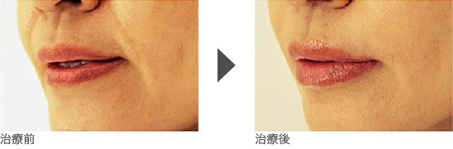口元 50代 女性